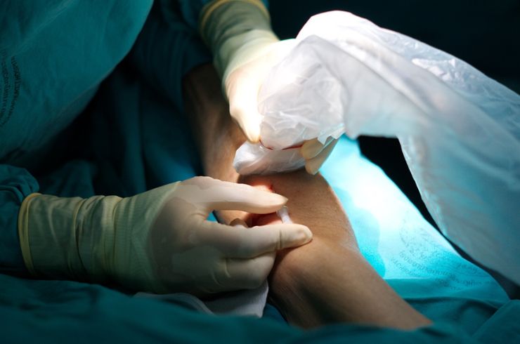 Ultrasound-Guided FNAC_Biopsy